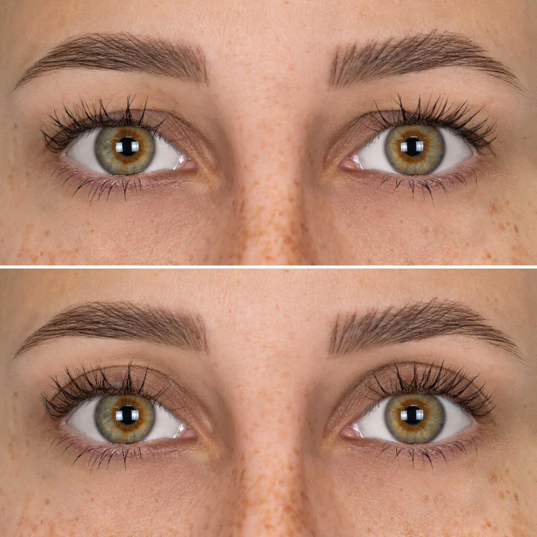 MiradaNova™ realza tus parpados caídos y rejuvenece tu mirada 👁️👁️