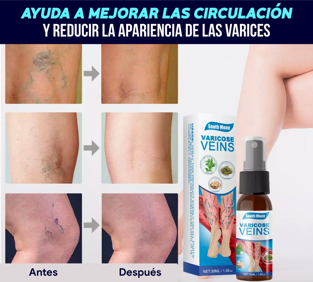 ZenVarix™ los únicos calcetines que eliminan tu hinchazón y varices de piernas + Spray Varices GRATIS